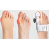 Шина для великого пальця ноги регульована Бандаж при Халюсі вальгус - Фото 5