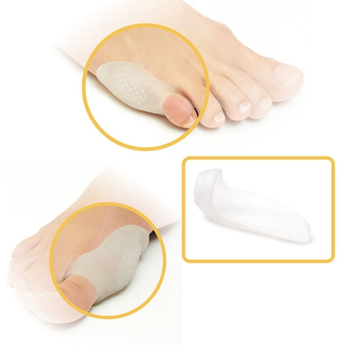 Gel protector for the bone GB-01 - Фото 4