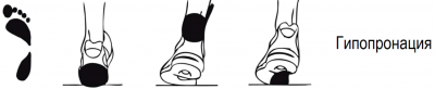 Hypopronation is a blog by Olvi.ua